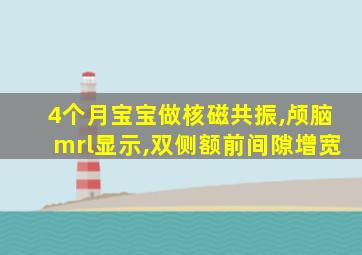 4个月宝宝做核磁共振,颅脑mrl显示,双侧额前间隙增宽