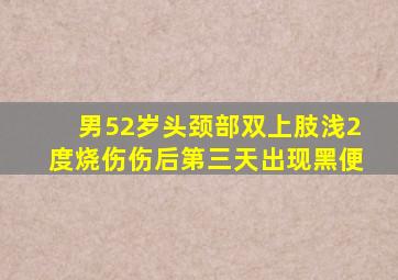 男52岁头颈部双上肢浅2度烧伤伤后第三天出现黑便